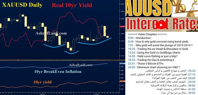 US Consumer Resilience & NZ Inflation Surge - Real Rates Gold Oct 18 2021 (Chart 1)